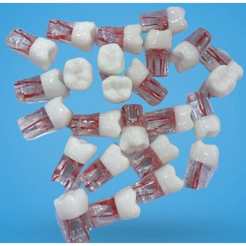 Dental material root canal with root canal resin with granules for treatment of open pulp cavity pulp examination