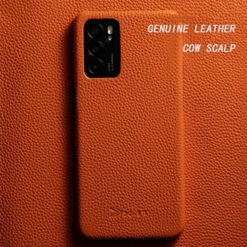 J DC Oppo A5 Pro + Phone Cases