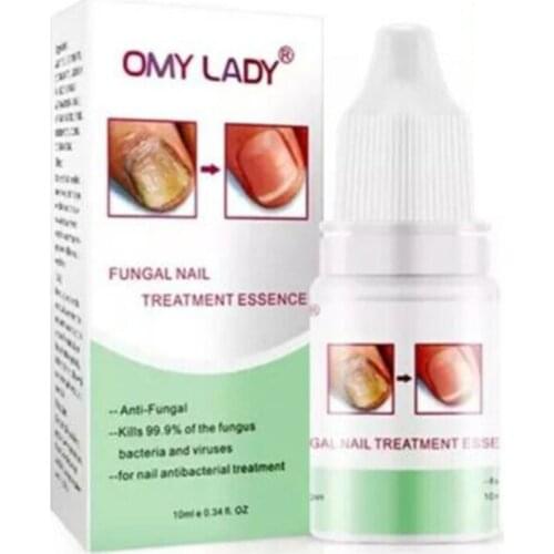 10ml Anti Fungal Nail Treatment Finger Toe Care Essence Liquid Pen Nail Repair Essence Serum Care Nail Problems Restore