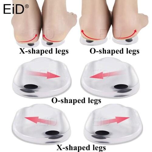 XO Legs magnet Orthotic Insoles Silicone Gel Arch Support Pad Flat Foot Orthopedic Inserts Pain Relief High Heel Shoe pad Unisex