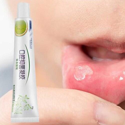 Mouth Ulcer Relief Gel Antibacterial Cream Natural Herbal Relief Severe Pain Irritation Within 2 Minutes Useful Painkillers