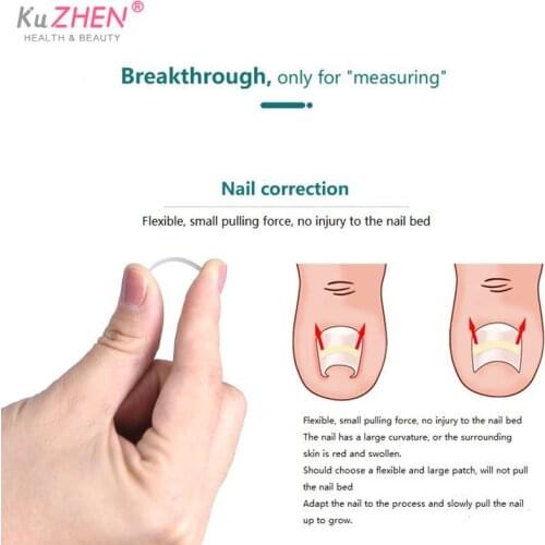 10pcs Straightening Clip Brace Pedicure Tool Ingrown Toenail Correction Tool Ingrown Toe Nail Treatment Elastic Patch Sticker
