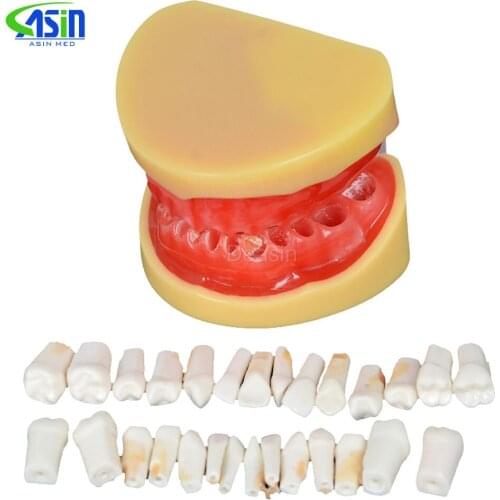 Dental All teeth Removable Standard Teeth Tooth Model 28 pcs teeth student learning model
