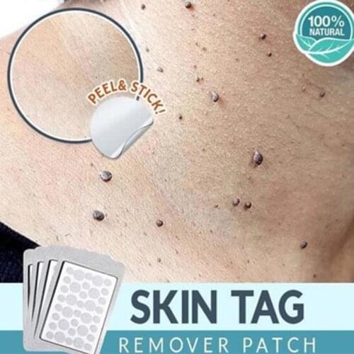 4 Sheets Wart Removal Stickers With 1pcs Wart Removal Pen Set Skin Tag Remover Patch Face Acne Pimple Hydrocolloid Master TSLM1