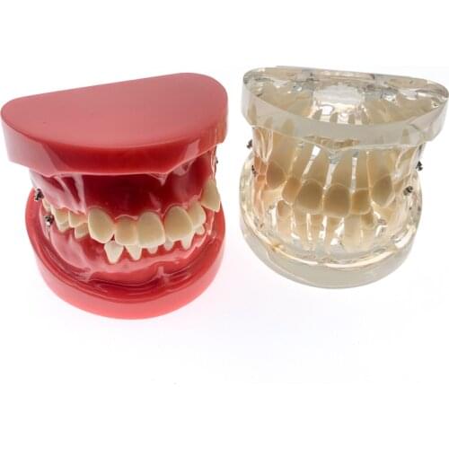 Teeth Model Dentist Orthodontic Tooth Model Demonstration Teaching Doctor-Patient research model for dentistry students