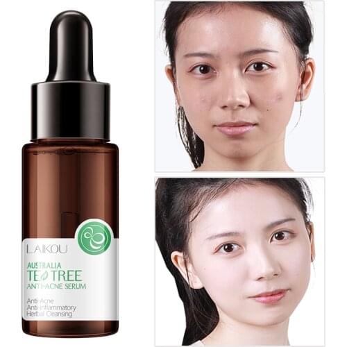 Tea Tree Oil Face Care Serum Skin Whitening Tightening Moisturizer Oil Control Serum Anti Aging Wrinkle Acne Treatment Skincare