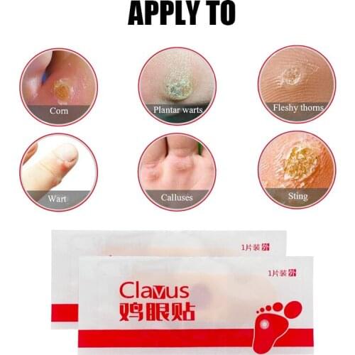 12Pcs Removal Killer Callus Corn Plaster Foot Care Sticker Chinese Medical Patch Corn Removal Pads Remove Callosity Detox