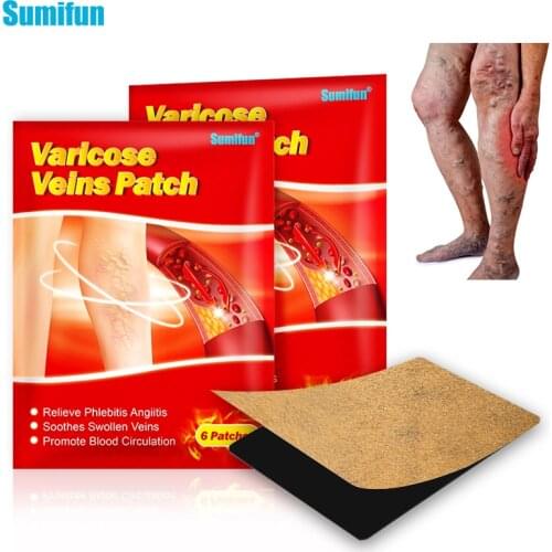 6pcs/Bag Varicose Veins Plaster Spider Leg Skin Care Treatment Vasculitis Phlebitis Chinese Medical Patch Angiitis Removal Patch