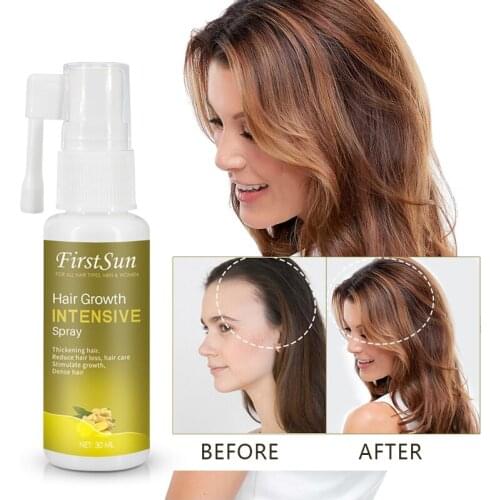 30ml Hair Growth Intensive Spray Natural Ginseng Ginger Extract Stimulate Strengthen Smooth Hair Anti Hair Loss Essence TSLM2