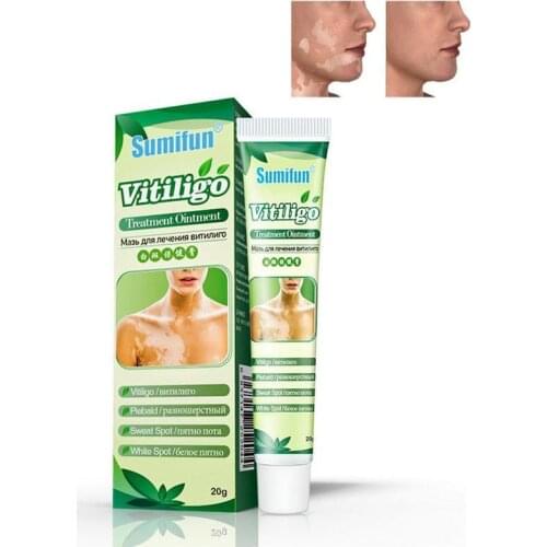 20g Chinese Medical Vitiligo Ointment Pigment Melanin Promoting Liniment Skin White Spot Leukoplakia Disease Treatment Cream