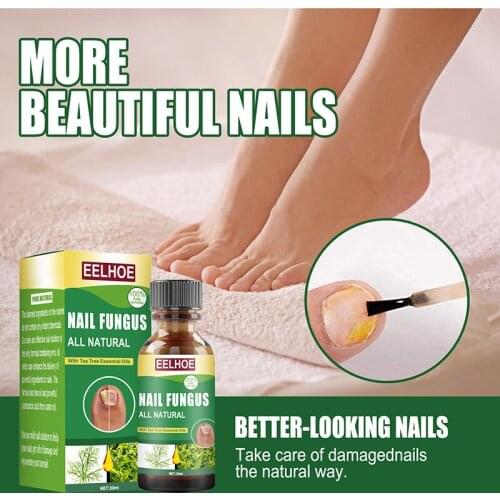 Fungal Nail Repair Serum Tea Tree Oil Onychomycosis Antibacterial Paronychia Nail Toe Fungus Foot Fast Repair Care Solution 30ml