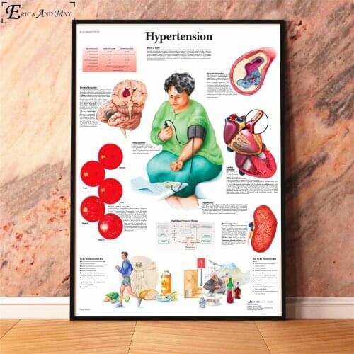 Anatomy Diseases Pathology Chart Posters And Prints Painting Wall Pictures For Living Room Medical Anatomy Home Decoration
