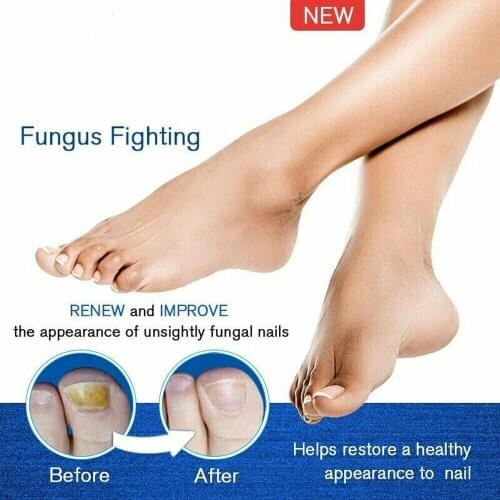 The Nail RepairLiquid Treatment Pen Onychomycosis Paronychia Anti Nail Infection