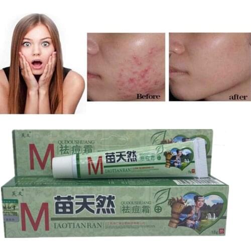 18g Acne Removal Cream Sterilization and Mite Removal Moisturizing Skin Cream Care Moisturizing Moisturizing Cream