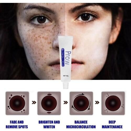 40g Effective Whitening Freckle Cream Remove Melasma Acne Spot Pigment Melanin Dark Spots For Face Care Whitening