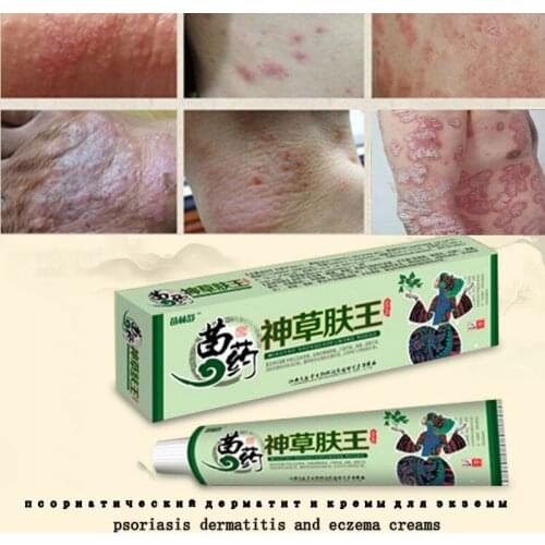 Skin Psoriasis Cream Dermatitis Eczematoid Eczema Ointment Psoriasis Treatment Psoriasis Cream Skin Care Cream Health Care