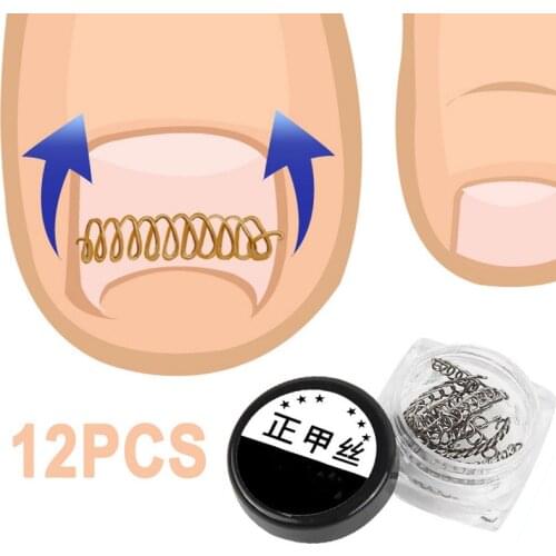 1Box Toe Nail Correction Nail Art Ingrown Toenails Paronychia File Patch Wire Remover Care Relief Pain Foot Pedicure Tools