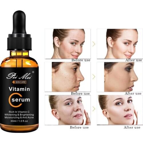 Vitamin C Facial Serum Deeply Moisturizing Remove dullness Whitening Face Essence Anti-acne Anti-Age Skin Care Product 30ml