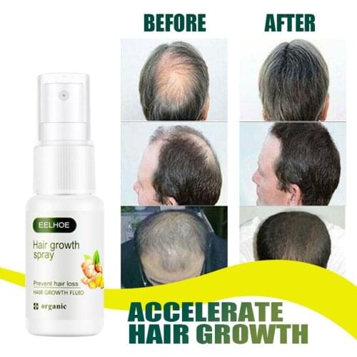 20ml Ginger Nutrition Hair Spray Hair Growth Serum Hair Care Fast Hair Growth Hair Spray Anti Hair Loss Natural Herbal Essence
