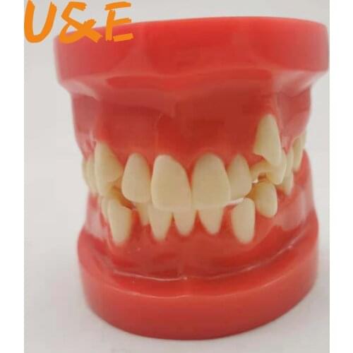 3D Resin Dental Model Teeth Malocclusion Model For Demostration Teaching Dentist Students Study Oral Medical Dentistry Products