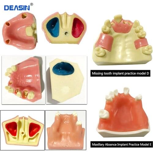 1 pc Dental implant dental model oral material practice maxillary sinus dental supplies instruments tools soft gum