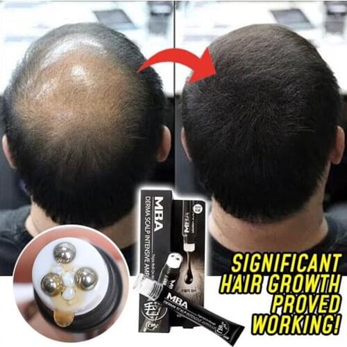 Scalp Intense Roll-on Hair Growth Serum Triple Roll Massager Fast Regrow Hair Line Anti Hair Loss Essence