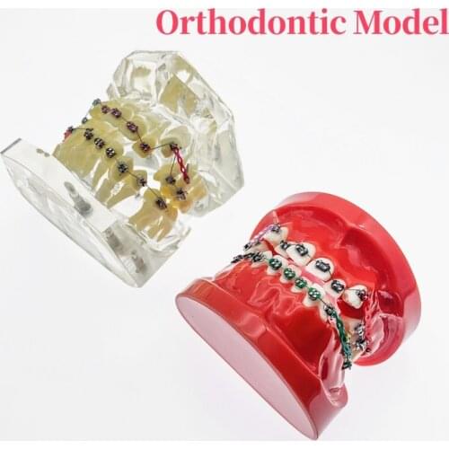 Dental Model Orthodontic Teeth Study Model With Brackets Chain Ties Arch Wire Dental Material