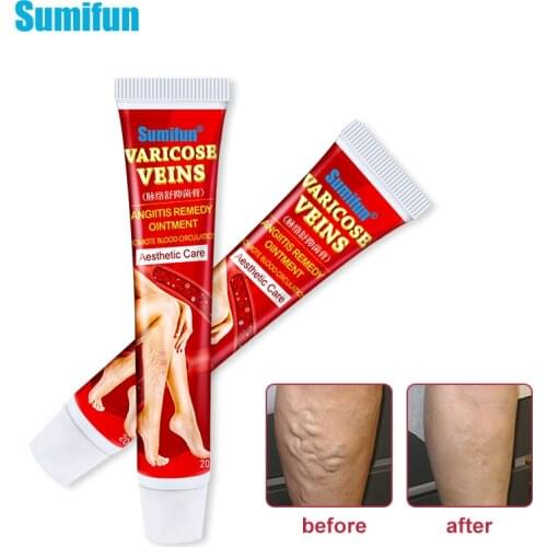1/2pcs Sumifun Varicose Veins Treatment Cream Original Vasculitis Phlebitis Spider Pain Relief Ointment Medical Plaster
