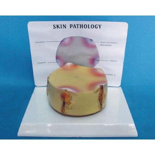 Human Skin Anatomical Magnification Model Skin Anatomy Model The Anatomy of The Skin Pathology Anatomy Medical Teaching Model