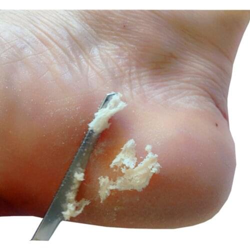 Pedicure Knife Foot Care Callus Dead Skin Remove Scraper Stainless Steel Scraper Exfoliating Rasp Foot Care Tools