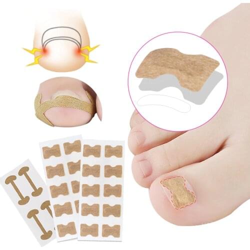 1Set Ingrown Toenail Corrector Sticker Paronychia Treatment Corrector Pedicure Foot Orthodontic Toe Thumb Nail Care Patches