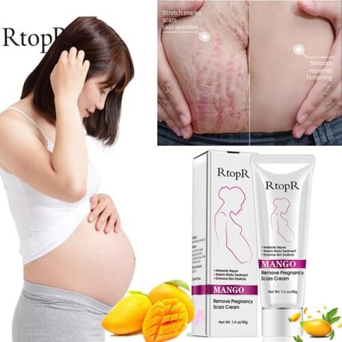 3PCS RtopR Pregnancy Scar Removal Cream Mango Non-irritating Women Pigment Correction Repair Body Gel Firm Brighten Stretch Mark
