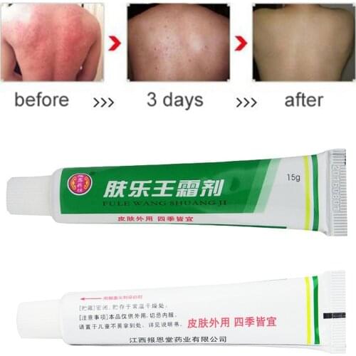 FULEWANG Skin Psoriasis Cream Dermatitis Eczematoid Eczema Ointment Treatment Psoriasis Cream 15g Herbal