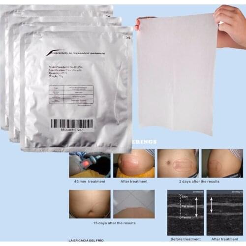 Brand New Antifreeze Membrane 27*30cm Antifreezing Anti-freezing Pad For Cold Therapy