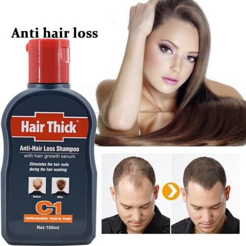 Dexe Anti-hair Loss Shampoo Herbal Hair Growth Serum Anti-dandruff Relieve Oil-control Unisex Thin Hair Stimulating Treatment
