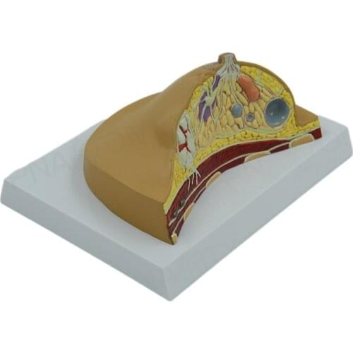 Female Breast Anatomical Model Diseased Chest Anatomy Medical Supplies and Equipment Humanbody Model Anatomy Teaching Resources