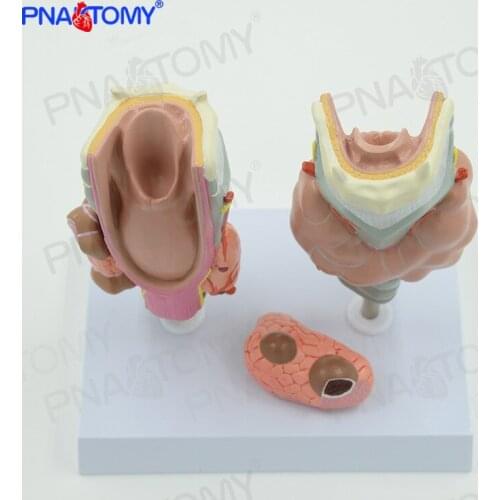 Thyroid Pathology Medical Anatomical Model of Larynx Hyperthyroidism Hypothyroidism Endocrine System Internal Medicine Specimens