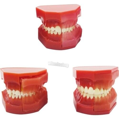 1Pcs Dental Tooth model Dental Children Tooth Teeth Anatomical Anatomy Model Dental teaching Model