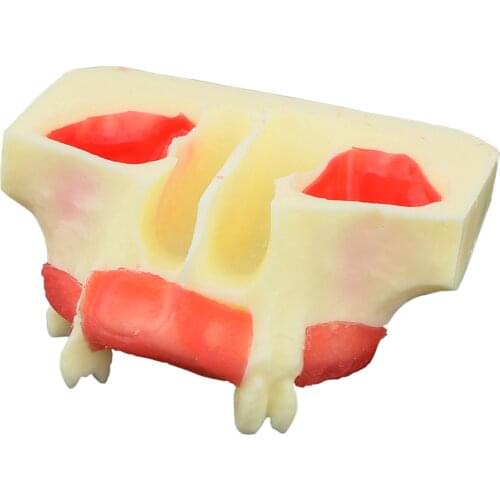 Dental Sinus Lift Practice Model Study Teaching Teeth Model M2013