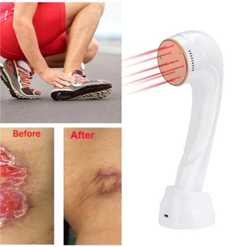Arthritis Back Pain Neck Pain Infrared Laser Therapy Portable Cold Laser Machine Cervical Spondylopathy Treatment instrument