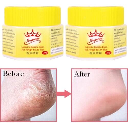 Dead Skin Remover Foot Care Cream Banana Paste Oil Hand Skin Anti-Drying Crack Cream Heel Chapped Peeling Repair Feet Mask