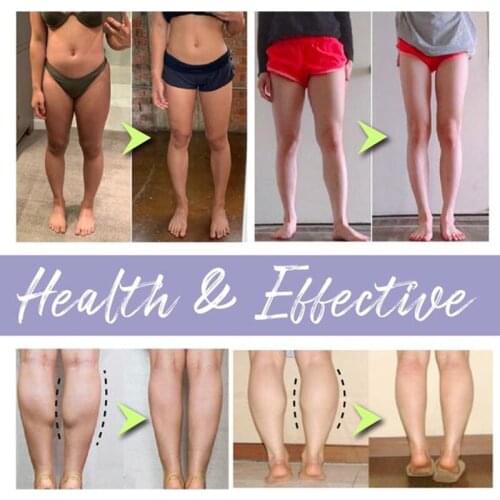 Winter Self-Heating Knee Protector Wormwood Hot Compress Cold Protection Knee Sleeve for Men Women B2Cshop