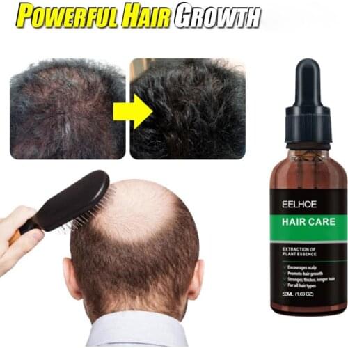 50ml Powerful Hair Loss Treatment Ginger Hair Care Growth Oil Hair Essential Oil Growth Anti Hair Loss Dry Damaged Repair TSLM2