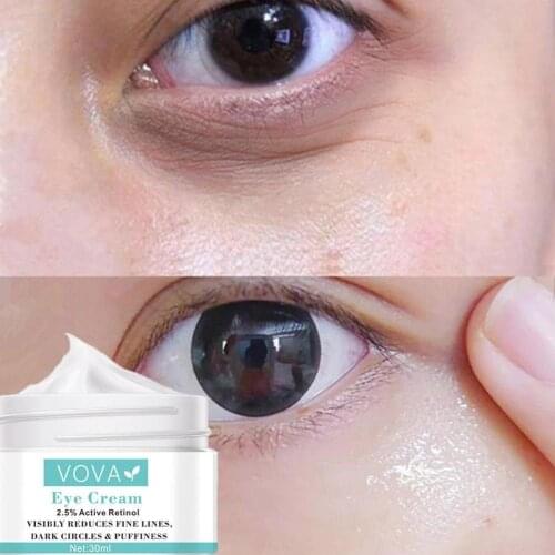 Instant Remove Eye Bags Cream Retinol Cream Anti Puffiness Brighten Gel Wrinkles Delays Fades Dark Circles Firming Skin Agi X6P0