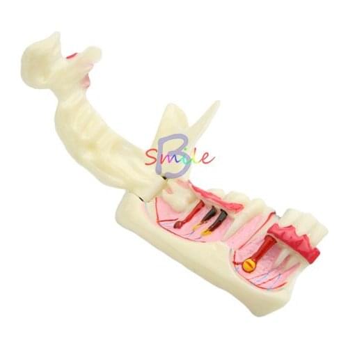Dental Mandibular Teeth Demonstration Anatomical Patient Teaching Model