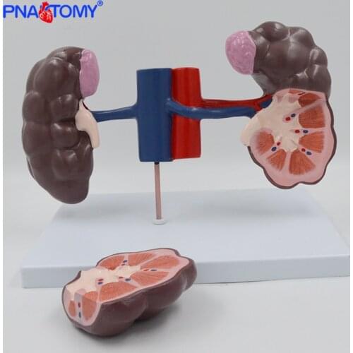 Kidney Anatomy Model of Cattle 2 Parts Animal Educational Anatomical Model Ox Cow Animal Husbandry Demonstrate Tool Medical