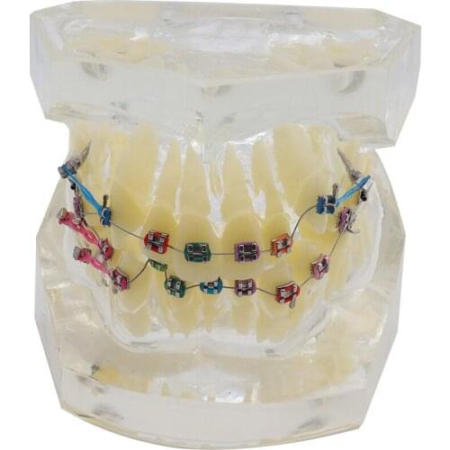 Dental Standard Orthodontic Teeth Model with Brackets & Buccal Tubes & Ligature Wire Orthodontic Treatment Transparent