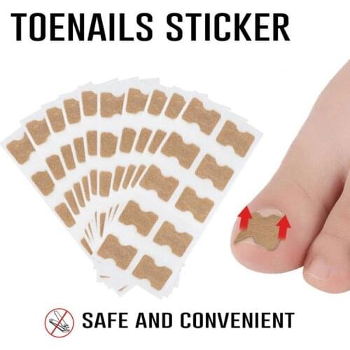 1/5/10pcs Nail Correction Stickers Ingrown Toenail Corrector Patches Paronychia Treatment Recover Corrector Pedicure Tools