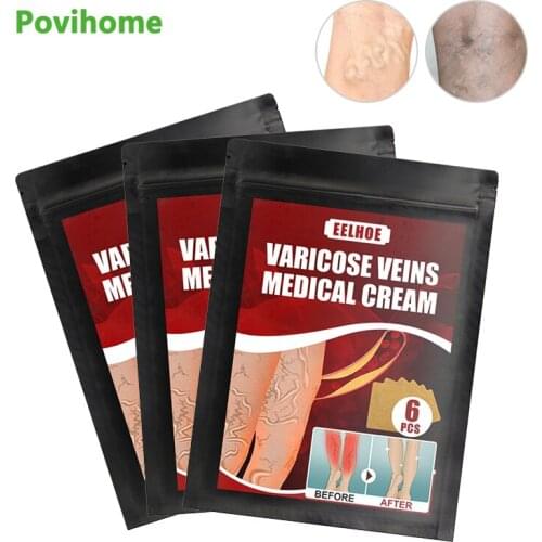6Pcs/Bag Varicose Veins Plaster Health Care Natural Herbal Extract Sticker Cure Varicosity Angiitis Remedy Pain Relief Patch