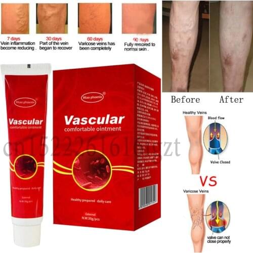 Ultra Strength Varicose Veins Treatment Cream Vasculitis Phlebitis Spider Veins Pain Varicosity Angiitis Remedy Removal Cream